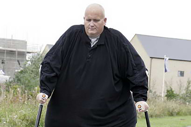  Самый толстый мужчина расстался со своей девушкой, ради которой похудел 300 кг