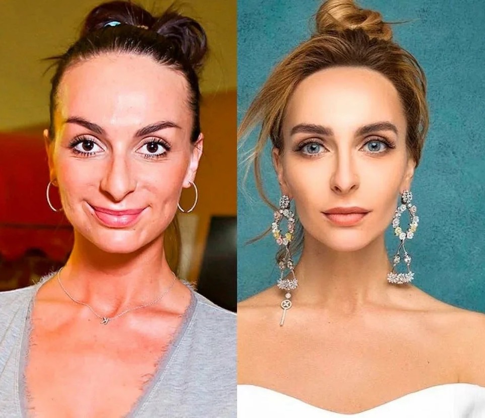 екатерина варнава фото до и после операции