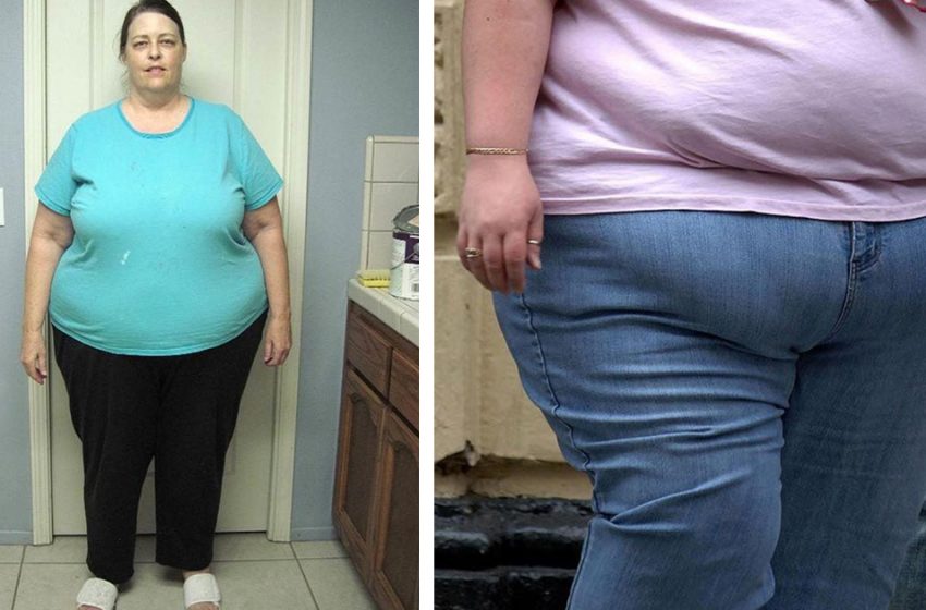  «Устала прятаться»: как 63-летняя женщина с весом в 180  кг изменила свою жизнь