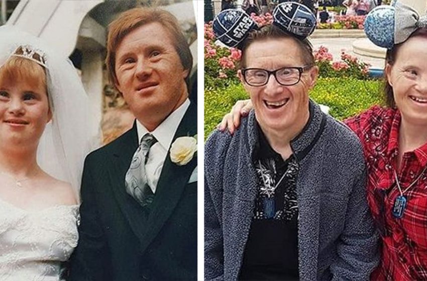  Az emberek ellen voltak a kapcsolatuknak: A Down-szindrómás pár házasodott és már 25 boldog év áll mögöttük!